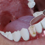本格的歯科医シム『Boring Game』発表―検査や歯列矯正、複雑な手術も