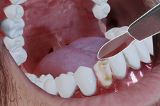 本格的歯科医シム『Boring Game』発表―検査や歯列矯正、複雑な手術も 画像