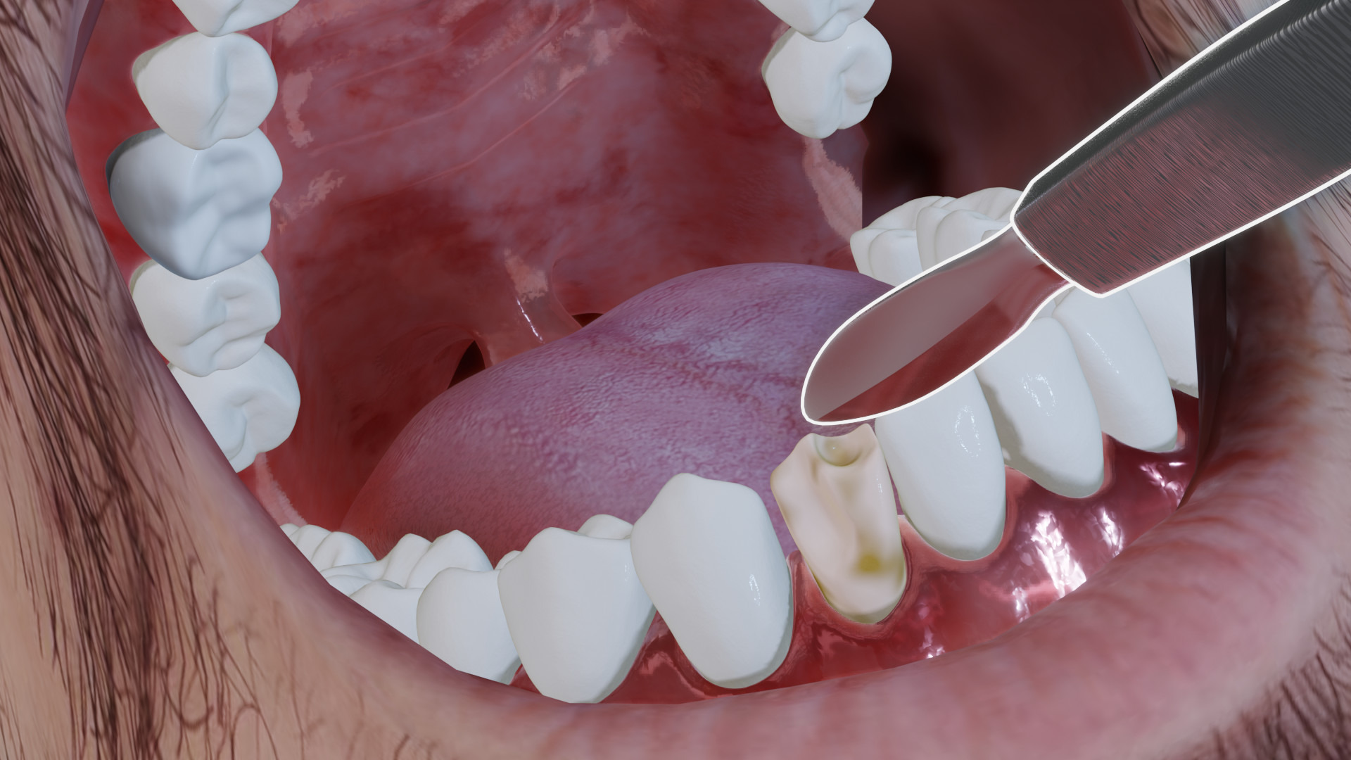 本格的歯科医シム Boring Game 発表 検査や歯列矯正 複雑な手術も Game Spark 国内 海外ゲーム情報サイト